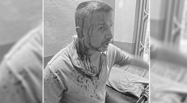 युवा संघ पर्वतको भेलामा झडप हुँदा केन्द्रीय सदस्य पौडेल घाइते