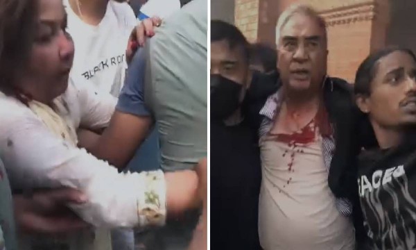 देउवाको टाउकोमा १२ टाँका लगाइयो